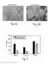 Fig. 06 - Polynucleotide constructs, pharmaceutical compositions and methods for targeted downregulation of angiogenesis and anticancer therapy
