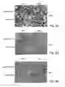 Fig. 08 - Polynucleotide constructs, pharmaceutical compositions and methods for targeted downregulation of angiogenesis and anticancer therapy