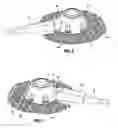 Fig. 05 - Implantable coupling device