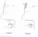 Fig. 03 - Implantable electrodes containing polyoxometalate anions and methods of manufacture and use
