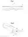 Fig. 02 - Stent suitable for deployment in a blood vessel