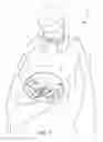 Fig. 02 - SALON GARMENT HAVING A CLEAR VIEWING WINDOW