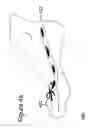 Fig. 07 - Apparel for a foot with multiofitting and multi-purpose capabilities
