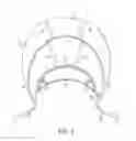 Fig. 04 - Lacrosse helmet cover