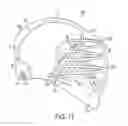 Fig. 11 - Lacrosse helmet cover