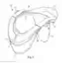 Fig. 04 - COMPRESSION UNDERGARMENT