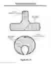 Fig. 10 - Straight Up Back Treatment