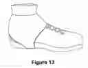 Fig. 09 - Debris inhibitor for shoes and methods for making same