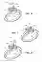 Fig. 04 - JEWELRY ARTICLES HAVING A SOLITAIRE CUT APPEARANCE AND A METHOD OF MAKING THE SAME