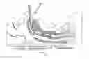 Fig. 01 - Pressurized tracheal cuff control arrangement