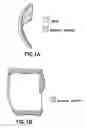 Fig. 02 - Positioning device for ankle joint replacement surgery