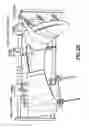 Fig. 05 - Positioning device for ankle joint replacement surgery