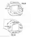 Fig. 09 - Positioning device for ankle joint replacement surgery