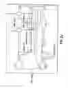 Fig. 12 - Positioning device for ankle joint replacement surgery