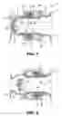 Fig. 02 - Fluid transfer device and system