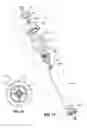 Fig. 07 - Primer bulb