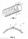 Fig. 02 - Flexible duct apparatus and method for use in aircraft environmental control systems