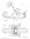 Fig. 02 - Power steering filter assembly