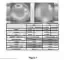 Fig. 07 - System and method for analyzing wavefront aberrations