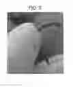 Fig. 05 - Image processing apparatus and method of processing color image data that perform overdrive