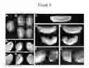 Fig. 06 - SECRETED MODULAR CALCIUM BINDING PROTEIN FOR INTRACELLULAR MODULATION OF BONE MORPHOGENETIC PROTEIN SIGNALING