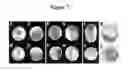 Fig. 08 - SECRETED MODULAR CALCIUM BINDING PROTEIN FOR INTRACELLULAR MODULATION OF BONE MORPHOGENETIC PROTEIN SIGNALING
