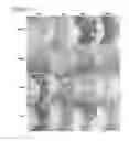 Fig. 09 - RABIES VACCINE