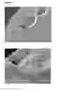 Fig. 02 - IMPLANTABLE DEVICES FOR TREATING HIV