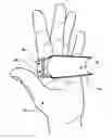Fig. 01 - Bar grip