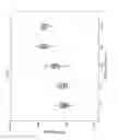Fig. 02 - METHOD FOR ASSESSMENT OF SEVERITY OF LIVER CIRRHOSIS