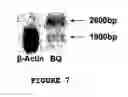 Fig. 08 - Catecholamine regulated protein