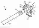 Fig. 01 - SUSCEPTIBILITY-BASED LOCAL FLOW DETECTION TO CONTROL MR-GUIDED ABLATION USING BALLOON DEVICES