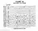 Fig. 28 - Patient-Specific Seizure Onset Detection System