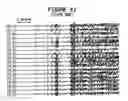 Fig. 29 - Patient-Specific Seizure Onset Detection System