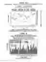 Fig. 33 - Patient-Specific Seizure Onset Detection System