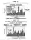 Fig. 38 - Patient-Specific Seizure Onset Detection System