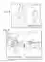 Fig. 07 - Computer-aided osteoplasty surgery system