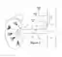 Fig. 02 - Focused ultrasonic renal denervation