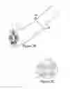 Fig. 05 - Focused ultrasonic renal denervation
