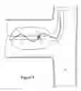 Fig. 11 - Focused ultrasonic renal denervation