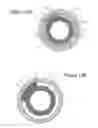 Fig. 16 - Focused ultrasonic renal denervation