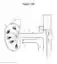 Fig. 20 - Focused ultrasonic renal denervation