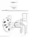 Fig. 22 - Focused ultrasonic renal denervation