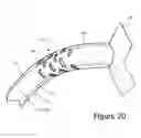 Fig. 23 - Focused ultrasonic renal denervation