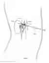 Fig. 10 - External autonomic modulation