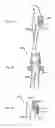 Fig. 12 - External autonomic modulation