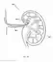 Fig. 22 - External autonomic modulation