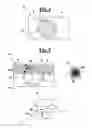 Fig. 03 - Ultrasonic apparatus for measuring a labor progress parameter