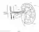Fig. 14 - Energetic modulation of nerves