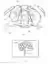 Fig. 17 - Energetic modulation of nerves